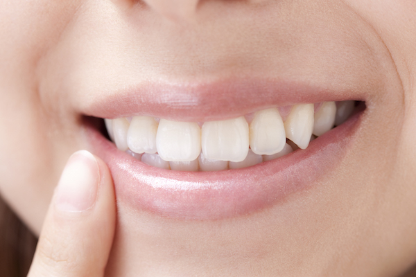 インプラントと入れ歯の違いはどんなところ？
